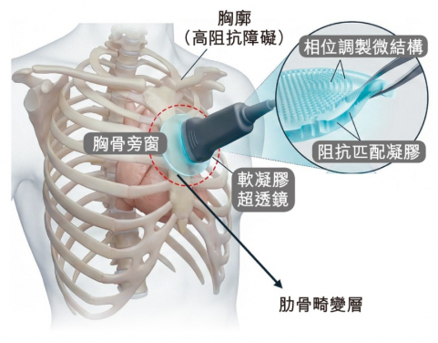 This AI-powered MetaLens can obtain complete, real-time, high-resolution images of the heart directly through the ribcage.